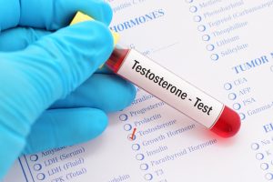 testosterone blood test